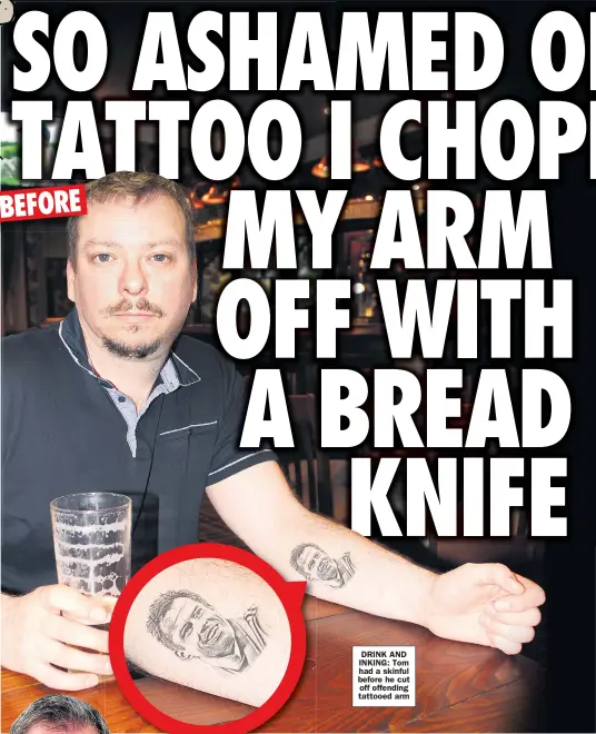  ??  ?? DRINK AND INKING: Tom had a skinful before he cut off offending tattooed arm