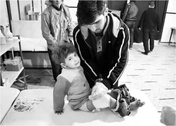  ??  ?? A wounded Syrian girl receives treatment at a make-shift hospital following reported air strikes on the rebel-held besieged town of Douma in the eastern Ghouta region on the outskirts of the capital Damascus. — AFP photo