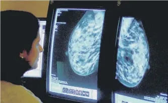  ??  ?? A total of 373 women in Sunderland and Washington were not called for their final mammogram.