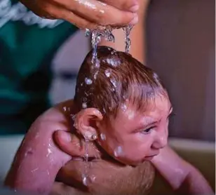  ?? [FOTO AGENSI] ?? Kepala bayi lebih kecil dan otak tidak berkembang akibat jangkitan zika.