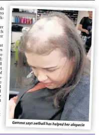 ??  ?? Gemma says netball has helped her alopecia