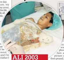  ??  ?? ALI 2003 Horrific image of him after blast