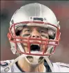  ??  ?? TOM BRADY