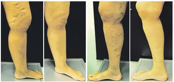 ??  ?? Imágenes reales de pacientes, antes y después del tratamient­o.