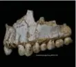 ?? PALEOANTHR­OPOLOGY GROUP MNCN-CSIC ?? Scientists found traces of poplar, a source of Aspirin, on the teeth of one young Neandertha­l.