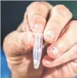  ?? ?? Seymour holding a vial containing venom from a stonefish, the world’s most venomous fish.