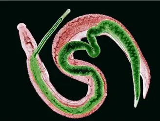  ?? Nibsc/Science Source ?? Vermes macho (marrom) e fêmea (verde) de que causam a doença
