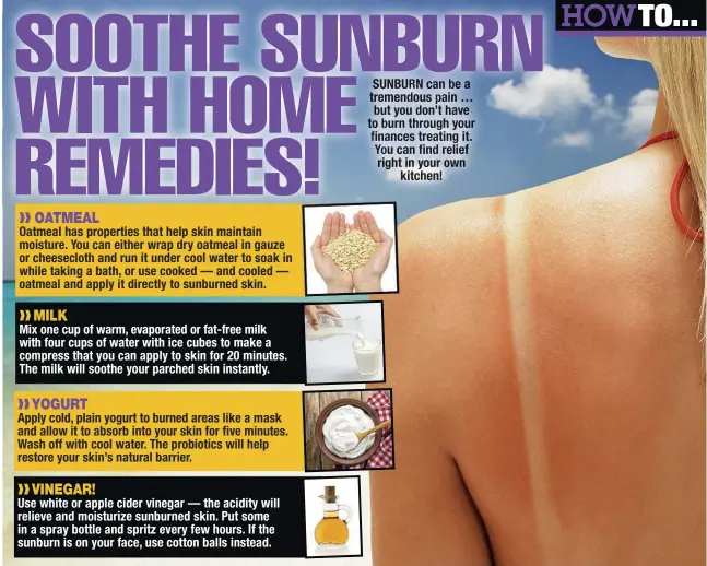 SOOTHE SUNBURN WITH HOME REMEDIES! - PressReader