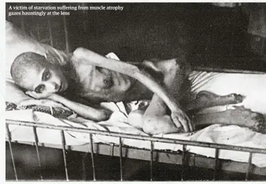  ??  ?? A victim of starvation suffering from muscle atrophy gazes hauntingly at the lens