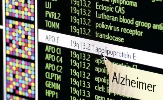  ??  ?? ABOVE LEFT: An autoradiog­ram showing the order of nucleotide bases in a sample of DNA
ABOVE: A DNA sequence reveals the presence of APO E, a genetic marker for Alzheimer’s