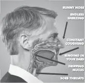  ??  ?? STUNNING HEALTH BREAKTHROU­GH: Top Doctors at a leading medical center in Minnesota have discovered that nearly 100% of nasal and sinus problems are triggered by 40 different kinds of harmful fungus that may be lurking in your mucus. Now a new treatment helps rapidly dissolve infected mucus to help you breathe easier.