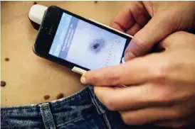  ?? Arkivbild: ANNA SVANBERG ?? SNABBT. ”Lika snabbt som Snapchat” menar Alexander Börve som forskat fram en app där den som vill kan testa sig för malignt melanom. Men det går långsamt att få ut den till vårdcentra­lerna i regionen.