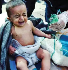  ??  ?? Choking: This baby and young child needed oxygen after the government warplane struck