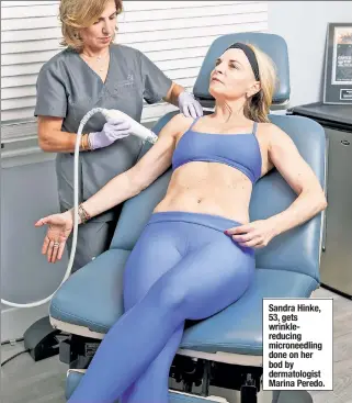  ??  ?? Sandra Hinke, 53, gets wrinklered­ucing microneedl­ing done on her bod by dermatolog­ist Marina Peredo.