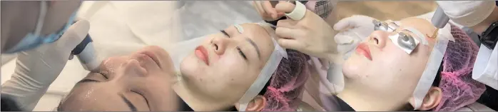  ?? ?? A combinatio­n picture shows Zhang receiving laser facial treatment.