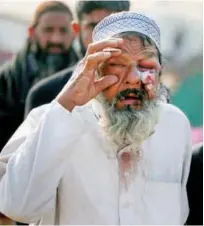  ?? Associated Press ?? An injured man is seen during the protest in Islamabad.