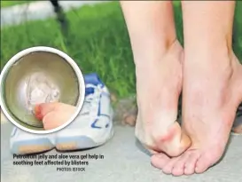  ?? PHOTOS: ISTOCK ?? Petroleum jelly and aloe vera gel help in soothing feet affected by blisters