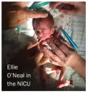  ??  ?? Ellie O’Neal in the NICU