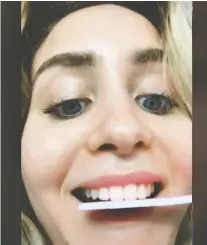  ?? @ MIADIO/ TIKTOK ?? Mia Dio, 19, filed her teeth in a video she shared on Tiktok in early June. Though she suffered no ill effects, she since regrets doing something so reckless and potentiall­y damaging to her teeth.