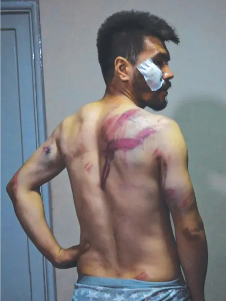  ?? Picture: AFP ?? Reporter Neamat Naghdi, 28, was beaten by Taliban fighters while covering a women’s protest march.