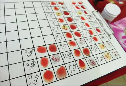  ??  ?? During blood donation drives, a chart like the one in this filepic, is used to determine a person’s blood type by seeing which antibody reacts with the person’s antigens.