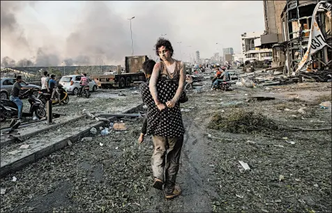  ?? HASSAN AMMAR/AP PHOTOS ?? Hoda Kinno is carried by her uncle Mustafa on Aug. 4 after a blast at the port of Beirut that killed more than 190 people.