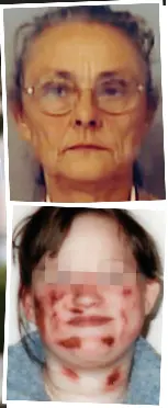 She Was Fed Cat Food Whipped And Kept In A Wheelchair To Claim Benefits Now As Her Sadistic Mother Is Freed Victoria S In Terror Again Pressreader