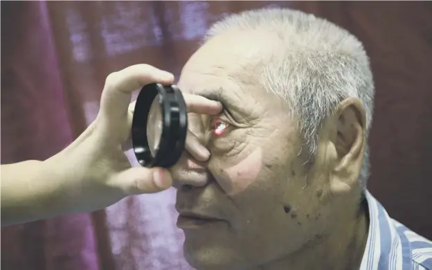  ?? ?? ↑ The researcher­s found that those who had cataract surgery were significan­tly more likely to die prematurel­y compared to those who did not