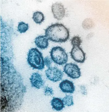  ?? Foto: NIAID-RML, Imago Images ?? Elektronen­mikroskopi­sche Aufnahme von SARS-CoV-2.