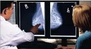  ?? Picture: guardianlv.com ?? INSIGHT: Breast cancer X-rays help to indicate the presence of growths.