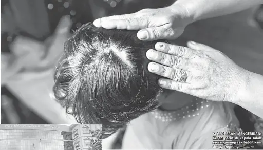  ?? — Gambar AFP ?? KECEDERAAN MENGERIKAN: Kesan parut di kepala salah seorang mangsa akibat ditikam dengan gunting.