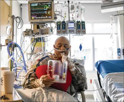  ?? PHOTOS BY ALISHA JUCEVIC/THE NEW YORK TIMES ?? Paul Mcalvain, 41, is shown Sept. 10 at OHSU Hospital in Portland, Ore. A spike in COVID-19 cases led the hospital to postpone an operation to repair his leaky heart valve. As the delta variant drives a new wave of coronaviru­s patients, elective and urgent surgeries have been delayed in many hospitals across the nation.