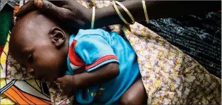  ?? Photo: UNICEF ?? Care… A baby being treated for malnutriti­on at a UNICEF-supported clinic in Niger. The country has a mere 0.35 doctors per 10 000 people, according to the WHO.