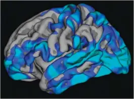  ??  ?? CORTICAL THICKNESS ❯ LEFT HEMISPHERE