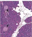  ?? FOTO:DIFE ?? Die Aufnahme zeigt Fettzellen (weiß) und Langerhans-Inseln (schwarze Pfeile) in der Bauchspeic­heldrüse einer übergewich­tigen Maus.