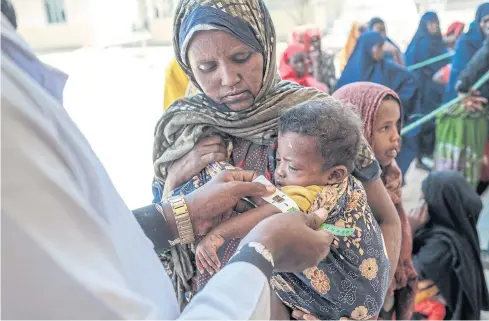  ?? AFP ?? Health staff measure an internally displaced child as the World Food Programme hands out food in a village near Gode, Ethiopia in April.