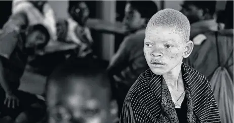  ?? Pictures: SORIN FURCOI/AL JAZEERA ?? LIVING IN FEAR: Latida Macho, 14, lives in the district of Dedza, in central Malawi. She didn’t go to school for three weeks following the murder of a boy with albinism in her district.