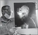  ?? [THE ASSOCIATED PRESS] ?? Hardi Baktiantor­o, of the Center for Orangutan Protection, shows an X-ray taken during surgery on an orangutan that died after being shot at least 130 times with an air rifle.