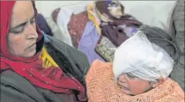  ?? PTI ?? Hiba Nisar, the youngest pellet victim, undergoes treatment at SMHS Hospital in Srinagar on Wednesday