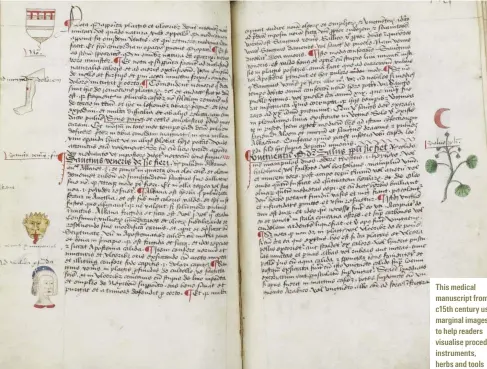  ??  ?? This medical manuscript from the c15th century used marginal images to help readers visualise procedures, instrument­s, herbs and tools