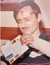  ?? HAMILTON SPECTATOR FILE PHOTO ?? Above: Karel Soucek, after his plunge over Niagara Falls on July 2, 1984, is holding post cards that he would have had friends mail to his family if he died in the attempt.