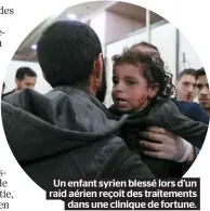  ??  ?? Un enfant syrien blessé lors d’un raid aérien reçoit des traitement­s dans une clinique de fortune.