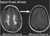  ??  ?? MEMORY-BOOSTING SENSATION: Doctors are now recommendi­ng Focus IQ because it supports better memory, recall, and higher intelligen­ce without a prescripti­on.