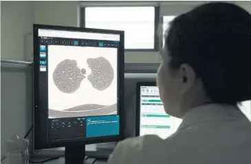  ??  ?? A doctor looks at CT scans of a patient’s lungs at the Zhejiang Provincial People’s Hospital in Hangzhou, China.