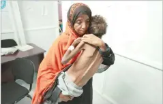  ??  ?? A woman carries her eight-year-old son, who is suffering from malnutriti­on in Yemen. ABDUL JABBAR ZEYAD/REUTERS