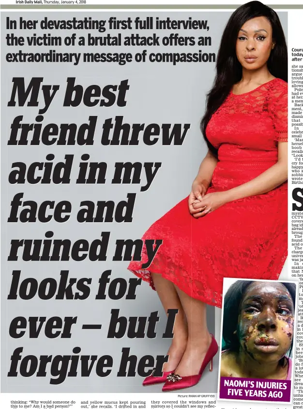  ?? Picture: RHIAN AP GRUFFYDD ?? Courageous: Naomi Oni today, aged 25, and (inset) after the acid attack