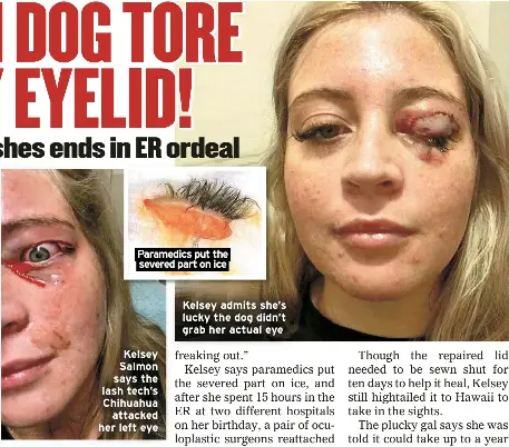 Demon Dog Tore Off My Eyelid Pressreader