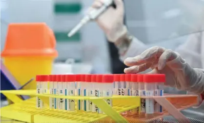  ?? ?? A laboratory technician uses a pipette to process Covid tests. Photograph: Justin Tallis/AFP/Getty Images