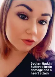  ??  ?? Bethan Gaskin: Suffered brain damage and a heart attack