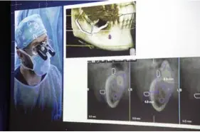  ??  ?? El Dr. José Carlos Martins Da Rosa fue el encargado de realizar una de las dos cirugías en directo, la de la Restauraci­ón Dentoalveo­lar Inmediata.